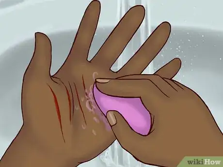 Imagen titulada Deal With a Cat Scratch Step 12