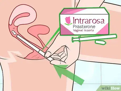 Imagen titulada Treat Dyspareunia Naturally Step 21
