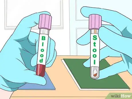 Imagen titulada Stop Rectal Bleeding Step 6