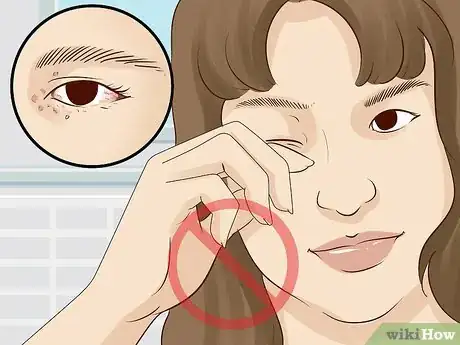 Imagen titulada Improve Under Eye Skin Step 2.jpeg