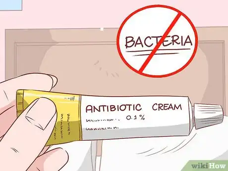 Imagen titulada Get Rid of Teen Acne Step 10