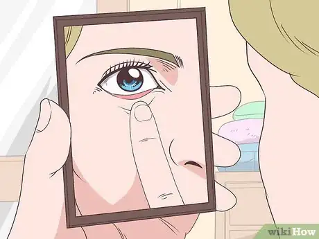 Imagen titulada Get Stuff out of Your Eye Step 2