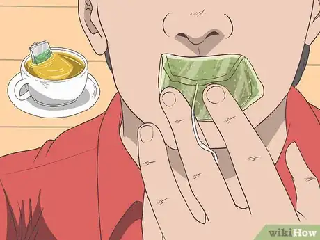 Imagen titulada Treat a Cold Sore or Fever Blisters Step 20