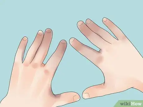 Imagen titulada Prevent Frostbite Step 22