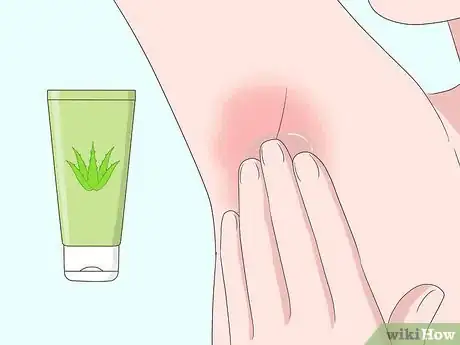 Imagen titulada Remove Armpit Hair Step 36