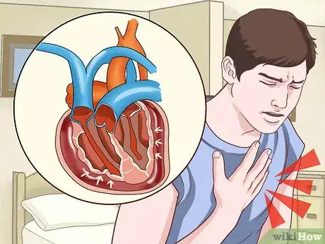 Imagen titulada Treat Obstructive Shock Step 3
