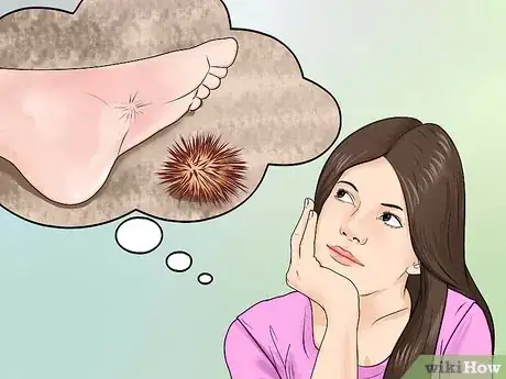 Imagen titulada Treat a Sea Urchin Sting Step 1
