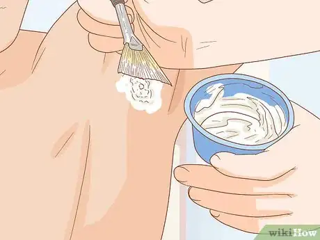 Imagen titulada Get Rid of Boil Scars Step 9