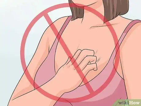 Imagen titulada Treat Itchy Breasts Step 8