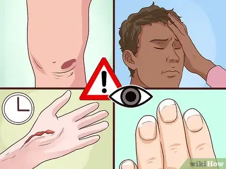 Imagen titulada Increase Albumin Step 14