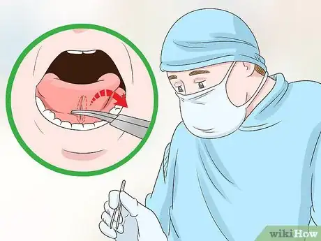 Imagen titulada Get a Longer Tongue Step 5