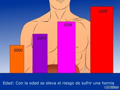 Imagen titulada Check_for_a_Hernia_Step_6Bullet2 ES.png