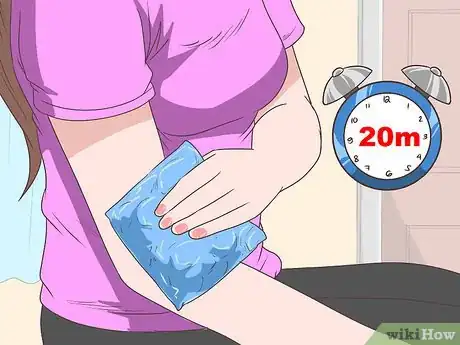 Imagen titulada Heal a Hyperextended Elbow Step 1