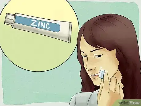 Imagen titulada Get Rid of a Cold Sore with Home Remedies Step 16