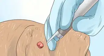 eliminar verrugas en perros