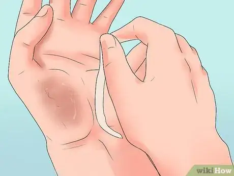 Imagen titulada Remove Steri Strips Step 11