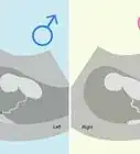 identificar el sexo de tu bebé durante el embarazo