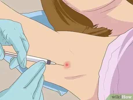 Imagen titulada Get Rid of a Zit on Your Armpit Step 15