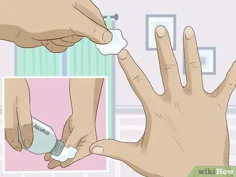 Imagen titulada Make Your Fingers Hard for Guitar Step 4.jpeg