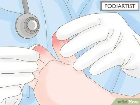 Imagen titulada Treat a Sore Toe Step 10