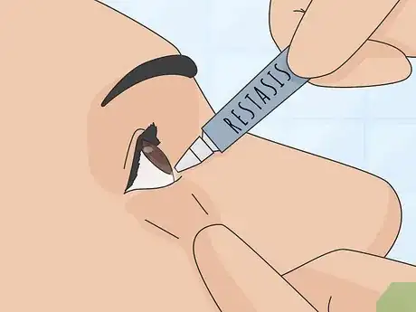 Imagen titulada Deal With Uncomfortable Contact Lenses Step 13