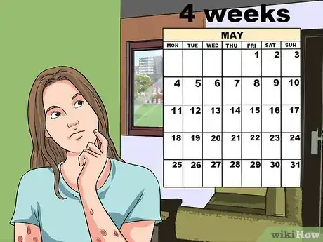 Imagen titulada Diagnose Scabies Step 15