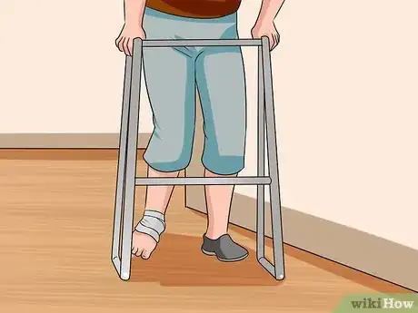 Imagen titulada Know if You've Sprained Your Ankle Step 16