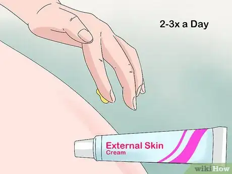 Imagen titulada Soothe Itching from Thrush Step 5