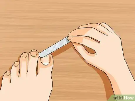 Imagen titulada Get Rid of Yellow Toenails Step 15