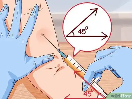 Imagen titulada Give a Shot Step 17