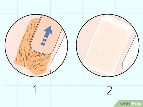 Imagen titulada Remove Armpit Hair Step 20