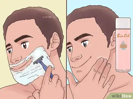 Imagen titulada Use Bio Oil Step 7