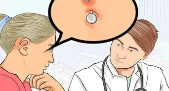 tratar una perforación de ombligo irritada