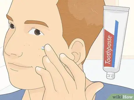 Imagen titulada Get Rid of Oily Skin Fast Step 9