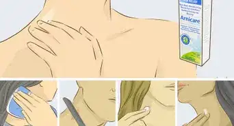 hacer un chupetón
