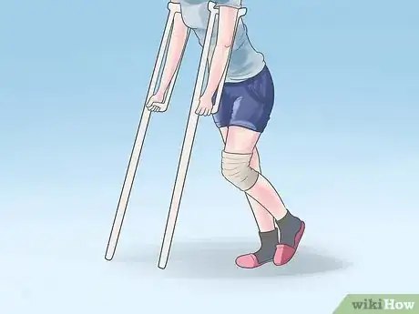 Imagen titulada Heal After Arthroscopic Knee Surgery Step 8