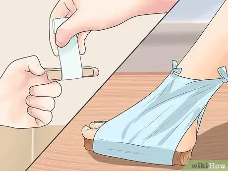 Imagen titulada Tell if a Fall Broke Bones Without an X Ray Step 11