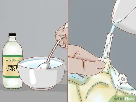 Imagen titulada Empty a Catheter Bag Step 12