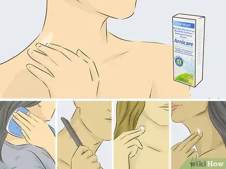 Imagen titulada Give Someone a Hickey Step 15
