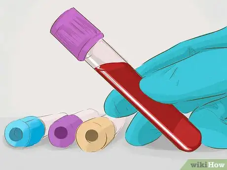 Imagen titulada Prevent Infections During Pregnancy Step 15