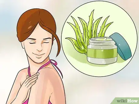 Imagen titulada Get Rid of a Sunburn Step 2