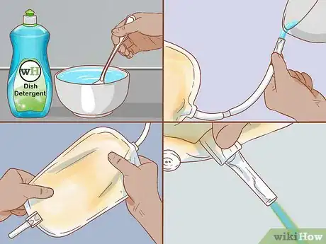 Imagen titulada Empty a Catheter Bag Step 11