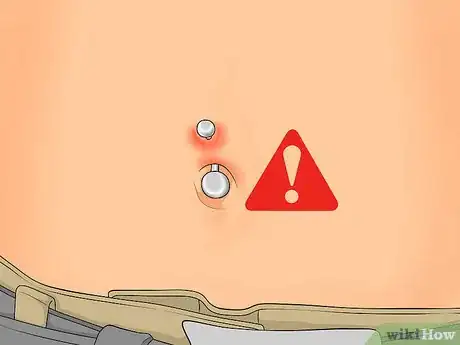Imagen titulada Treat an Irritated Belly Button Piercing Step 10