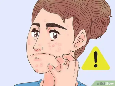 Imagen titulada Use Bio Oil Step 5