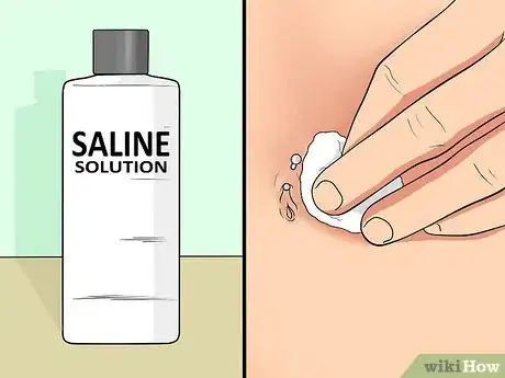 Imagen titulada Treat an Irritated Belly Button Piercing Step 13