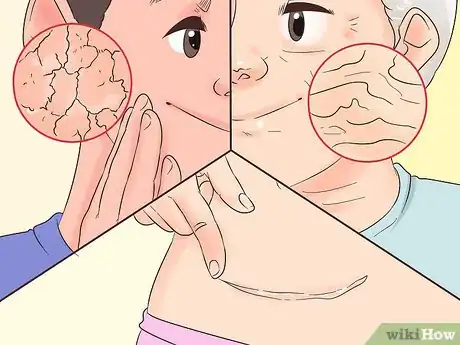 Imagen titulada Use Bio Oil Step 4