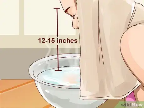 Imagen titulada Get Rid of a Deep Pimple Step 8