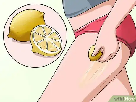 Imagen titulada Get Rid of Stretch Marks Fast Step 6