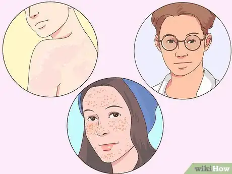 Imagen titulada Determine Skin Tone Step 4