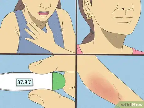 Imagen titulada Get Rid of a Rash Step 12